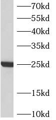      anti- ATP5F1 antibody