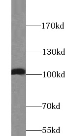      anti- ATP1A1 antibody