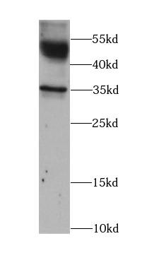      anti- ATP1B1 antibody