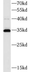      anti- ATP5C1 antibody