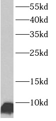      anti- ATP5J antibody