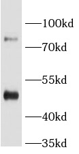      anti- BAAT antibody