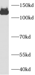      anti- AZI1 antibody