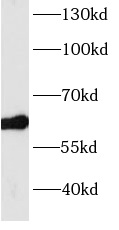      anti- BBS4 antibody