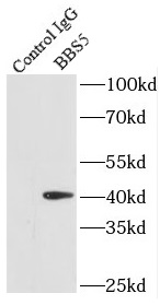 anti- BBS5 antibody