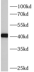 anti- BBS5 antibody