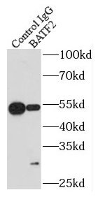 anti- BATF2 antibody