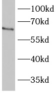      anti- BBS1 antibody