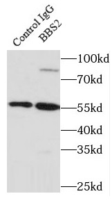 BBS2抗体