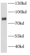 anti- BBS2 antibody