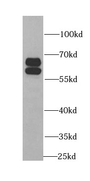      anti- BAIAP2 antibody