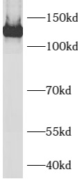      anti- AXL antibody