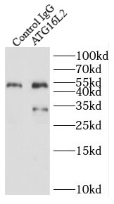 ATG16L2抗体