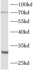      anti- ATG16L2 antibody