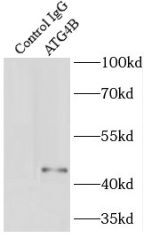      anti- ATG4B antibody