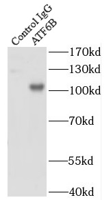      anti- ATF6B antibody