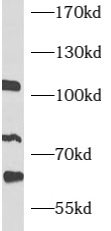      anti- ATF6B antibody