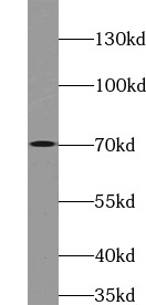 anti- ATG16L1 antibody