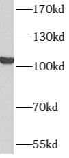      anti- ATN1 antibody