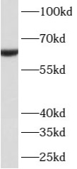      anti- ATL3 antibody