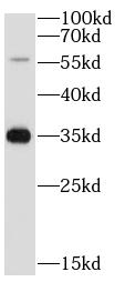      anti- ATP4B antibody