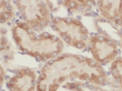      anti- ASPH antibody