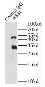      anti- ASS1 antibody