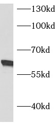 anti- ASNS antibody