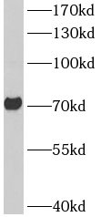      anti- ASIC2 antibody