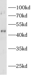      anti- ASTL antibody