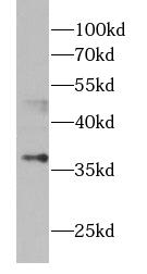      anti- ASPA antibody