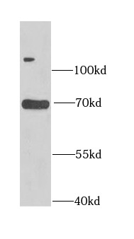      anti- ASMTL antibody