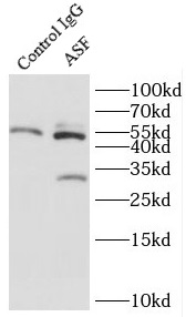      anti- ASF/SF2 antibody