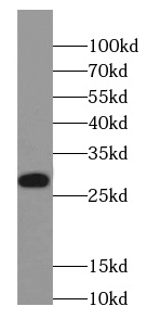      anti- ASF/SF2 antibody