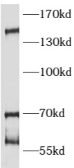      anti- ATAD5 antibody