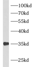      anti- ATF1 antibody