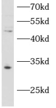      anti- ATAD1 antibody