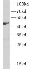      anti- ASL antibody