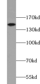      anti- ASK1 antibody