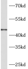      anti- ASAM antibody