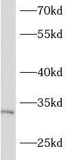      anti- ASB17 antibody