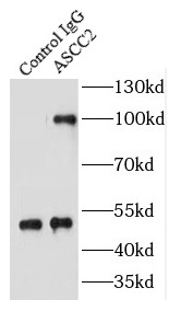      anti- ASCC2 antibody