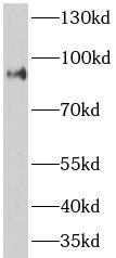      anti- ASCC2 antibody