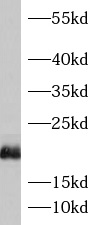      anti- ASF1B antibody