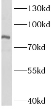      anti- ASH2L antibody