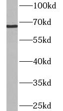      anti- ASB14 antibody