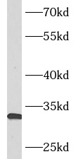      anti- ASB8 antibody