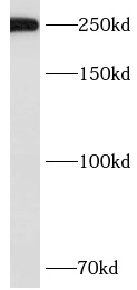      anti- ASCC3 antibody