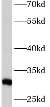      anti- ASB9 antibody