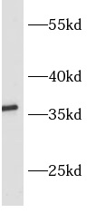      anti- ASPRV1 antibody